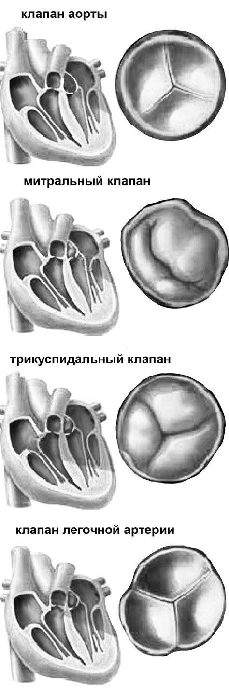 Р.Н.Ягудина Приобретенные пороки сердца