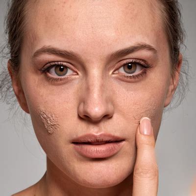 identify common skin problems dr priyanka aggarwal