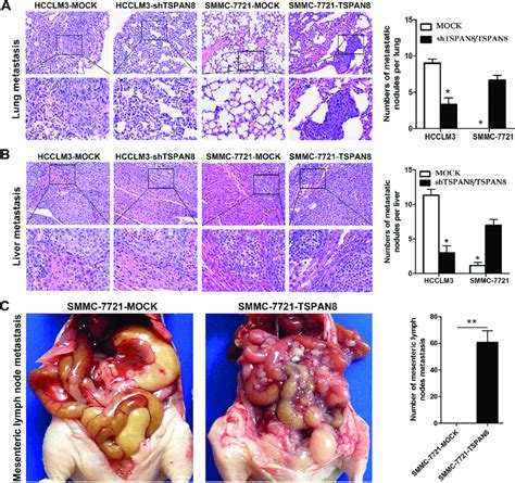 High expression of TSPAN8 promoted HCC metastasis and invasion in vivo ... 