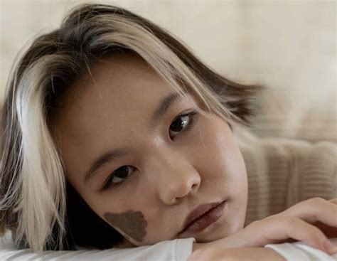 types  birthmarks   spiritual meanings