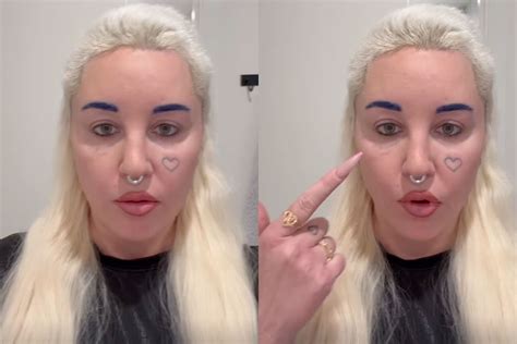 Amanda Bynes Reveals Progress on Removing Her Heart Face Tattoo