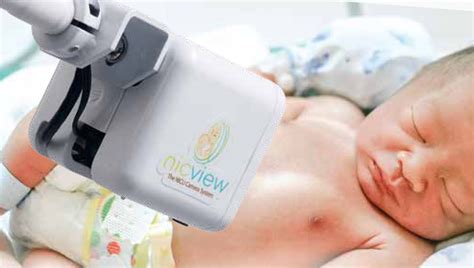 NICVIEW WEBCAM SYSTEM - Neonatal Care Academy