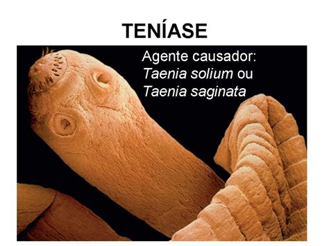 BIOLOGIA: Verminoses