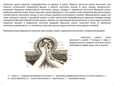Околопупочная, или параумбиликальная грыжа — причины, симптомы и лечение