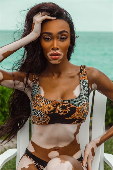 Winnie Harlow Fappening Topless (10 Photos) | #The Fappening