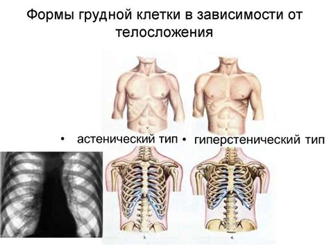 Грудная клетка - презентация онлайн