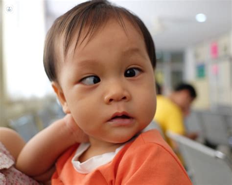 Understanding strabismus (squints)