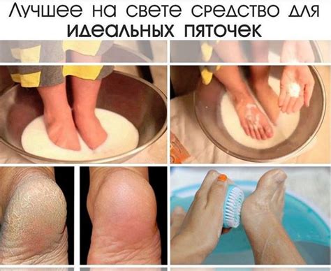 Чем помазать мозоль на ноге: Введите символы с картинки — Сиеста ...