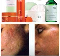 49 Before and After Pic. ideas | arbonne, pure products, arbonne consultant