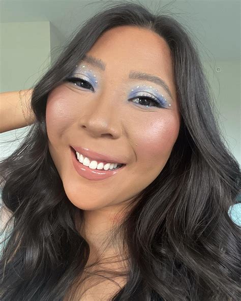 A Woman With a Face Birthmark Shares What Is Like to Always Have People ...