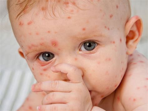 canine chicken pox 6