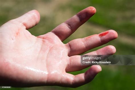 bloody finger high res stock photo getty images