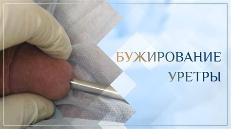 🚼 Бужирование уретры. Клинический случай №17 - YouTube