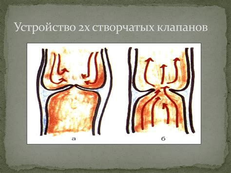 Варикозное расширение вен нижних конечностей - презентация онлайн