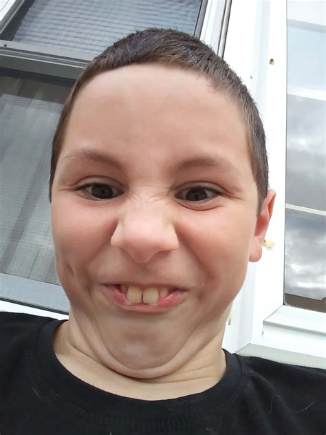 Download Boy Bunny Teeth Face Funny Pictures 1920 x 2560 | Wallpapers.com