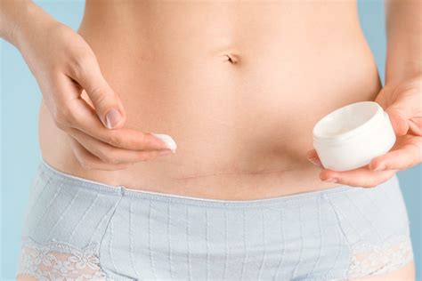 Top Must-Have Self-Care Items Following Vaginal or Cesarean Birth