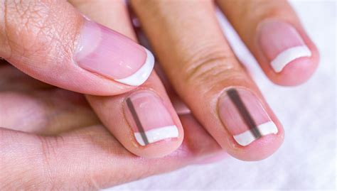 How to Get Rid of Black Lines on Nails - Health For Best Life