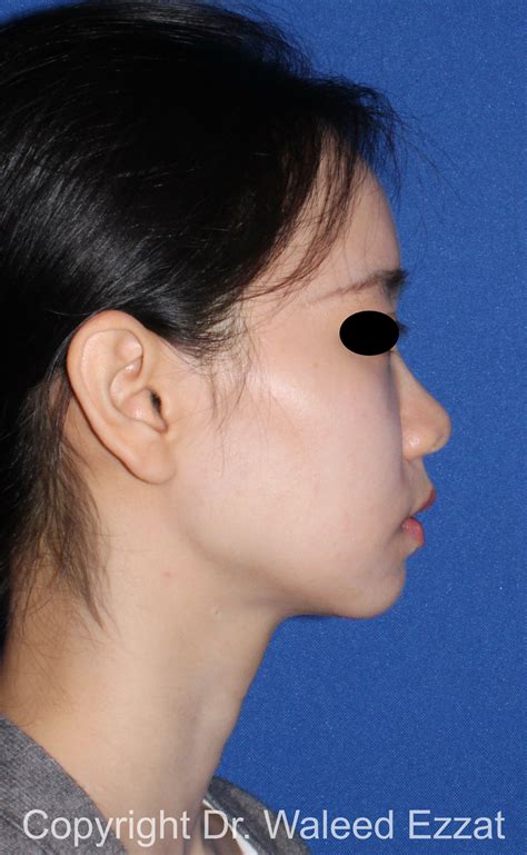 216 - The Boston Center For Facial Plastics