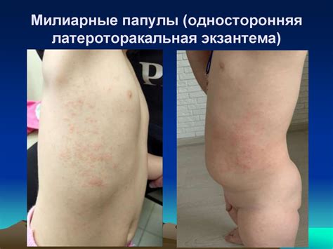 Введение в дерматовенерологию - презентация онлайн