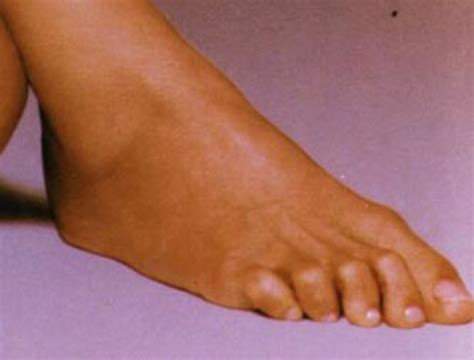 Celebrity Feet Photos: Whose Famous Toes Are These? - HubPages
