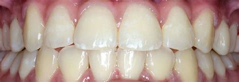 Ortodoncija | AbDental