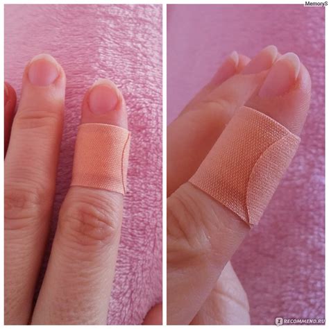 Пластырь Pure plast Дышащий эластичный медицинский бактерицидный ...