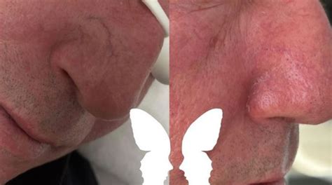 Skin and Laser - Manchester Aesthetics