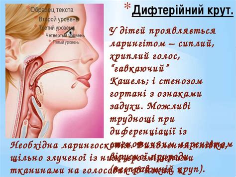 Дифтерія - презентація з медицини