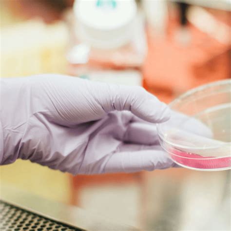 specimen management  guide  nurses