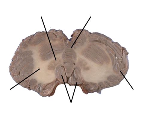 diagram  transverse section quizlet