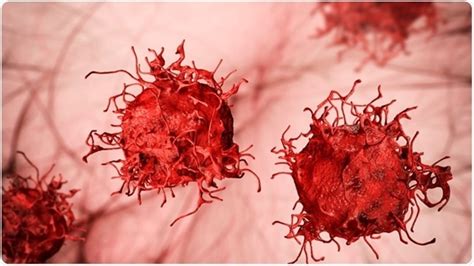 What is a Neoplasm?