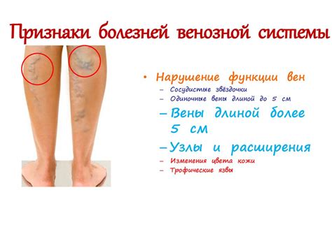 Компрессионный трикотаж - презентация онлайн