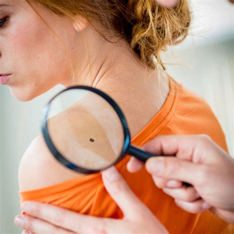 Do You Still Need a Regular Skin Check? A Dermatologist Explains