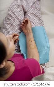 Open Wound Stock Photo 171516776 | Shutterstock