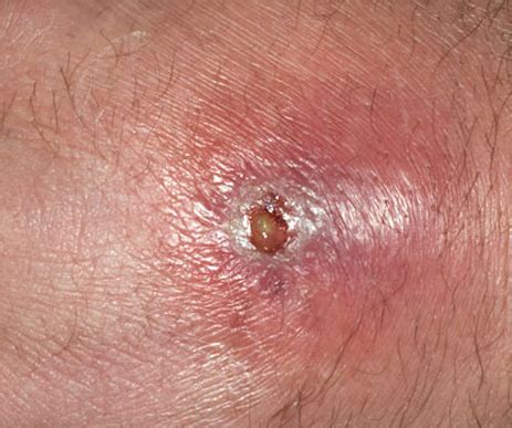 sameera piles clinic mumbai navi mumbai