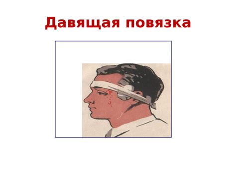 Приемы временной остановки наружного кровотечения - презентация онлайн