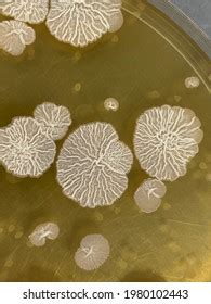 closeup bacteria bacillus subtilis colonies  stock photo
