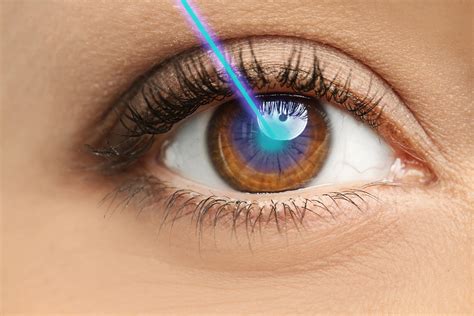 Laser Eye Surgery - Smart Laser Eye Center