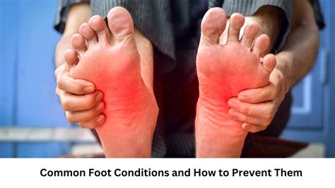 Common Foot Conditions And How To Prevent Them - Michigan Avenue ...