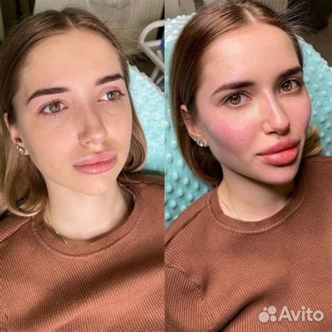 Косметолог/Фулл фейс/Лицо под ключ в Екатеринбурге | Услуги | Авито