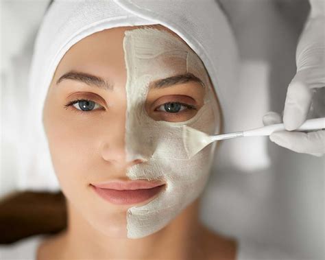 chemical peeling dremel polat