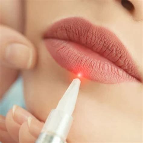 dark lips treatment abu dhabi laser treatment abu dhabi