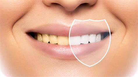 yellow teeth nutritionfactin