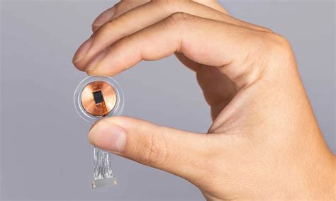 Neuralink – After First Successful Implant, What Comes Next