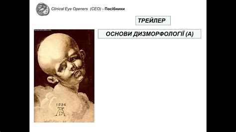 Основи дизморфології - трейлер - YouTube