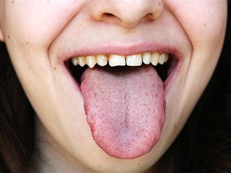 "Healthy Tongue" Images – Browse 29 Stock Photos, Vectors, and Video ...
