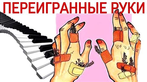 Переигранные руки - это крест? Как не переиграть руки? Причины и ...