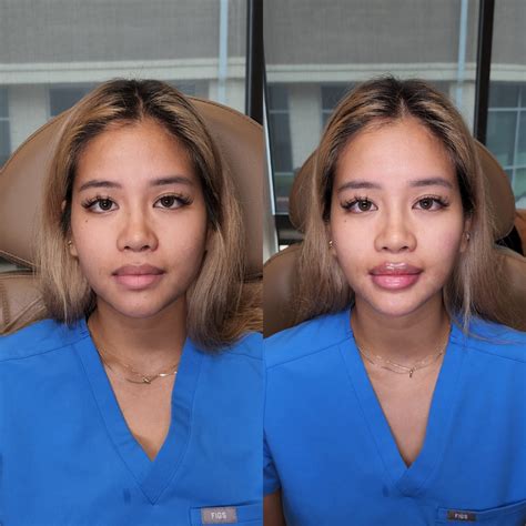 SummerXiris OnlyFans: Before & After The Leak