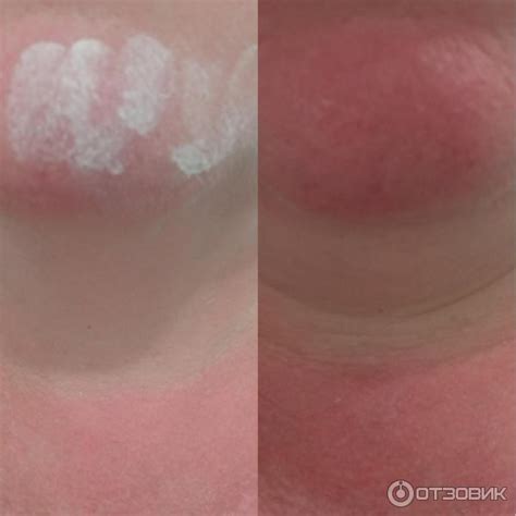Отзыв о Крем-барьер от загара, веснушек и пигментации Floresan SPF 30 ...
