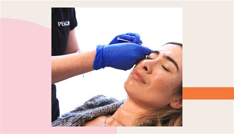 Botox Before and After: Watch Our Editor Get Injected | Well+Good